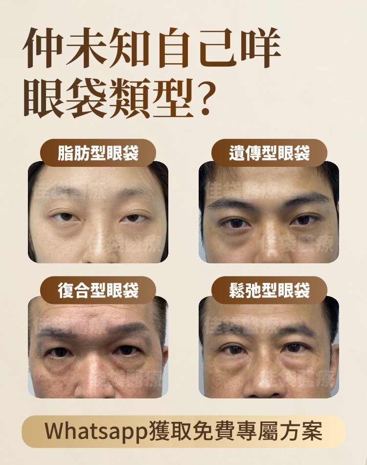 仲未知自己咩眼袋類型 免費專屬方案
